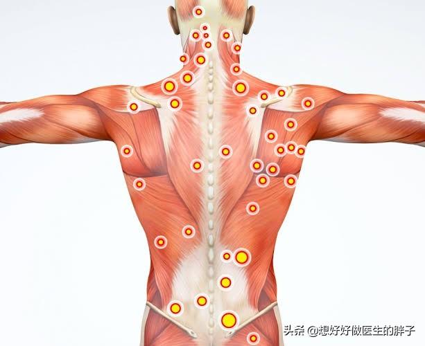 筋膜炎最新研究與治療進(jìn)展